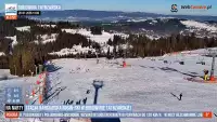 Tatry Super Ski to grupa 19 stacji narciarskich posiadająca łącznie 118 tras co przekłada się na 84 km tras zjazdowych,